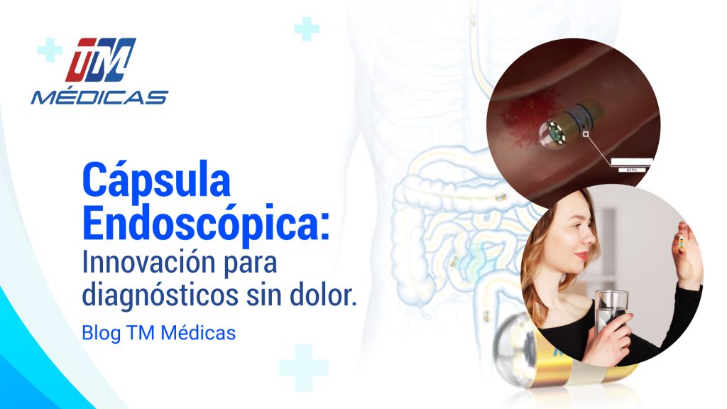 Cápsulas endoscópicas: Innovación para diagnósticos sin dolor.